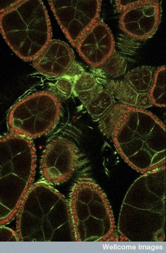 CIL:39043, Drosophila melanogaster, egg, invertebrate nurse cell