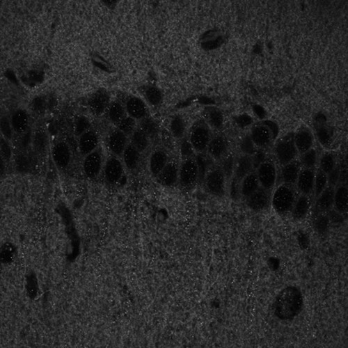 CIL:40154, Mus musculus, CNS neuron (sensu Vertebrata)