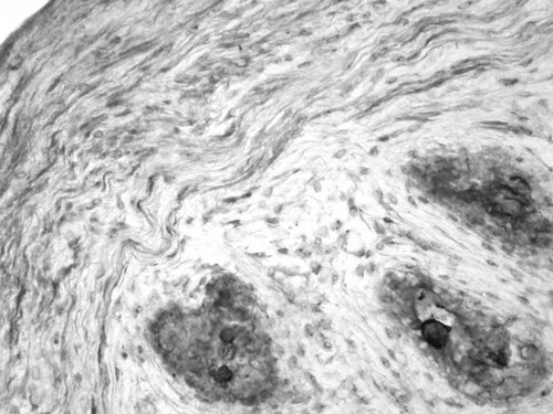 CIL:32193, Homo sapiens, endocrine-paracrine cell of prostate gland, basal cell of prostate epithelium, luminal cell of prostate epithelium, blood vessel endothelial cell, perineural cell, sheath cell, leukocyte, prostate stromal cell, smooth muscle cell of prostate