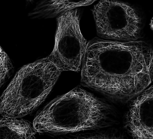 CIL:41694, Homo sapiens, epidermoid carcinoma