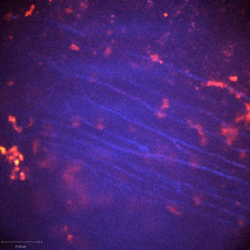 CIL:47378, Staphylococcus aureus, neutrophil, endothelial cell