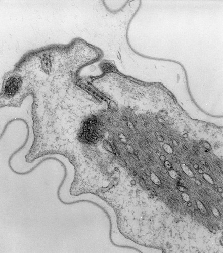 CIL:39510, Vorticella convallaria, cell by organism, eukaryotic cell, Eukaryotic Protist, Ciliated Protist