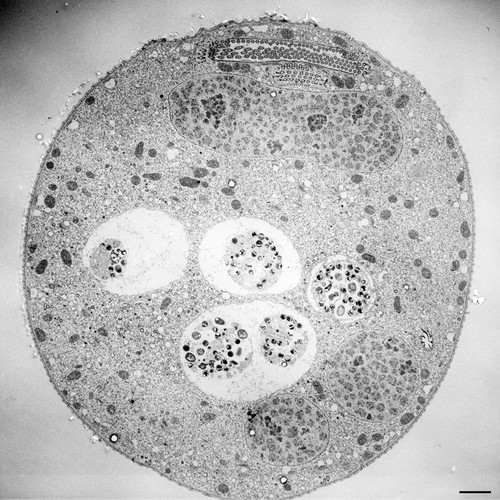 CIL:36248, Vorticella convallaria, cell by organism, eukaryotic cell, Eukaryotic Protist, Ciliated Protist