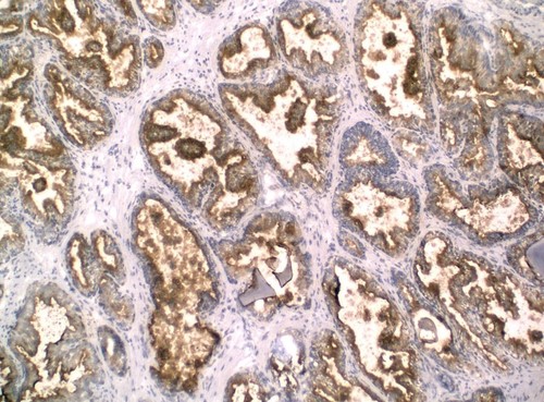 CIL:32584, Homo sapiens, endocrine-paracrine cell of prostate gland, basal cell of prostate epithelium, luminal cell of prostate epithelium, blood vessel endothelial cell, perineural cell, sheath cell, leukocyte, prostate stromal cell, smooth muscle cell of prostate