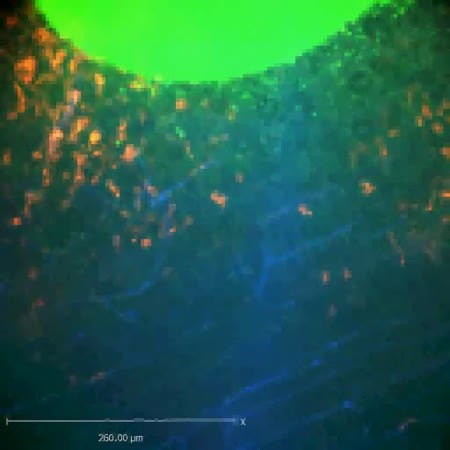 CIL:47523, Staphylococcus aureus, neutrophil, endothelial cell