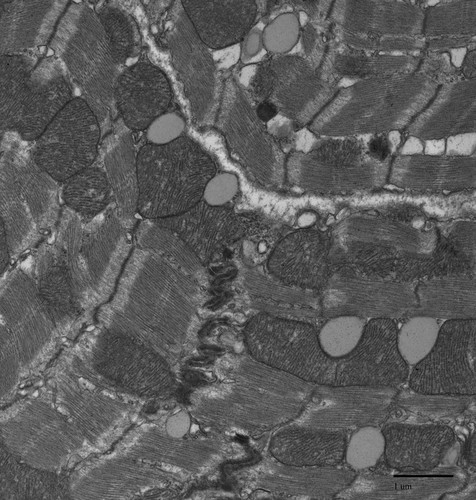 CIL:39765, Mus musculus, cardiac muscle cell