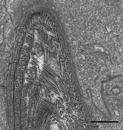 CIL:27224, Fundulus heteroclitus, scale