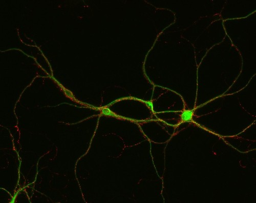 CIL:12548, Rattus, multipolar neuron