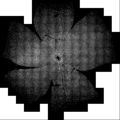 CIL:47052, Mus musculus, retinal ganglion cell