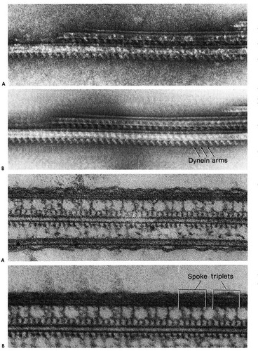 CIL:11627, Tetrahymena sp. SPE01, Elliptio crassidens, ciliated cell, ciliated epithelial cell