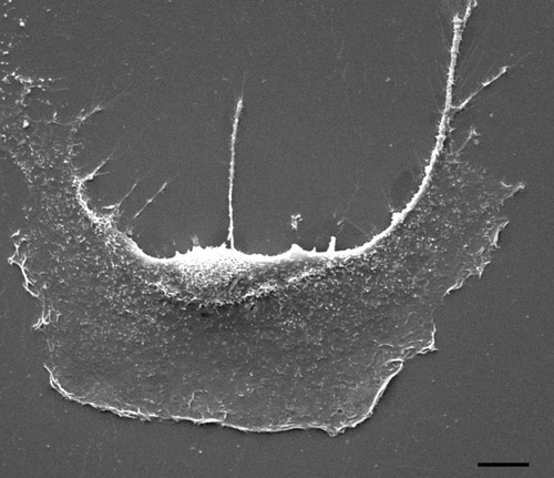 CIL:12600, Mus musculus, bone-marrow-derived fibroblast