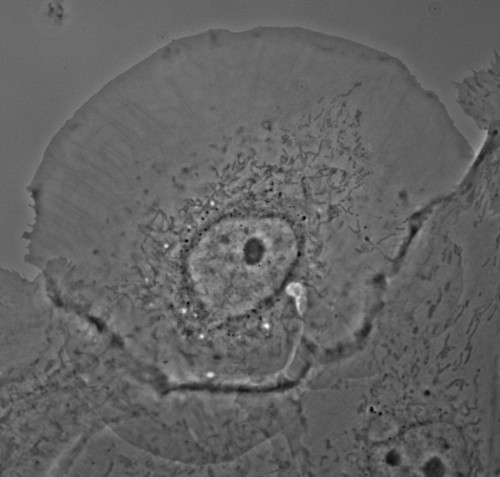 CIL:147, Potorous tridactylus, epithelial cell