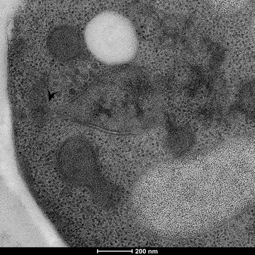 CIL: 50844, Saccharomyces cerevisiae (baker's yeast, budding yeast), Mixed population of S. cerevisiae cells