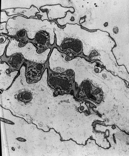 CIL:38827, Coleps hirtus, eukaryotic cell, Eukaryotic Protist, Ciliated Protist