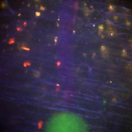 CIL:47515, Staphylococcus aureus, neutrophil, endothelial cell