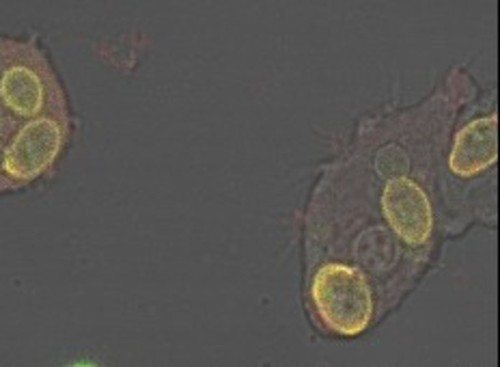 CIL:7328, Dictyostelium discoideum, cell by organism, eukaryotic cell, amoeboid cell, Eukaryotic Protist