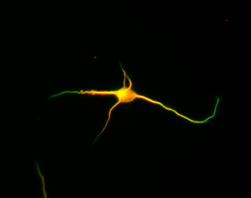 CIL:8463, Rattus, multipolar neuron