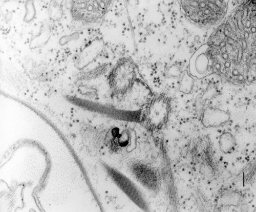 CIL:13156, Paramecium multimicronucleatum, cell by organism, eukaryotic cell, Eukaryotic Protist, Ciliated Protist