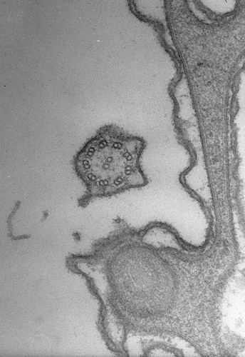 CIL:38893, Paramecium caudatum, cell by organism, eukaryotic cell, Eukaryotic Protist, Ciliated Protist