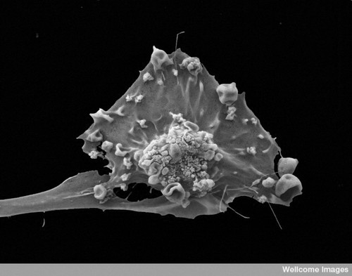 CIL:38813, breast cancer cell