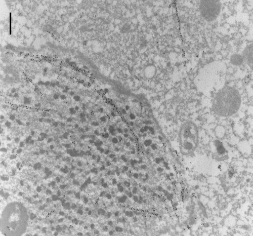 CIL:9859, Paramecium tetraurelia, cell by organism, eukaryotic cell, Eukaryotic Protist, Ciliated Protist