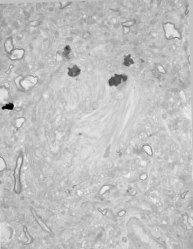 CIL:40027, Homo sapiens, pyramidal cell, neuron of cerebral cortex