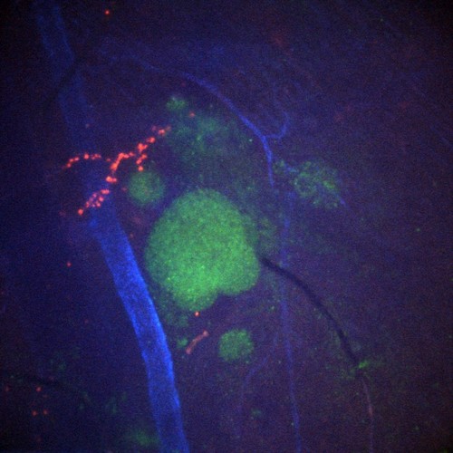 CIL:47676, Staphylococcus aureus, neutrophil, endothelial cell