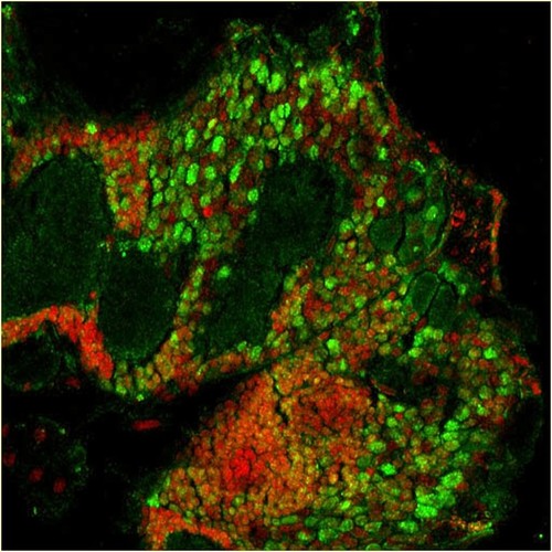 CIL:25382, Maize mosaic virus, Peregrinus maidis, CNS neuron (sensu Nematoda and Protostomia)