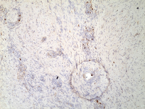 CIL:32528, Homo sapiens, endocrine-paracrine cell of prostate gland, basal cell of prostate epithelium, luminal cell of prostate epithelium, blood vessel endothelial cell, perineural cell, sheath cell, leukocyte, prostate stromal cell, smooth muscle cell of prostate