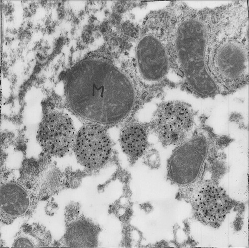 CIL:46704, Homo sapiens, parenchymal cell