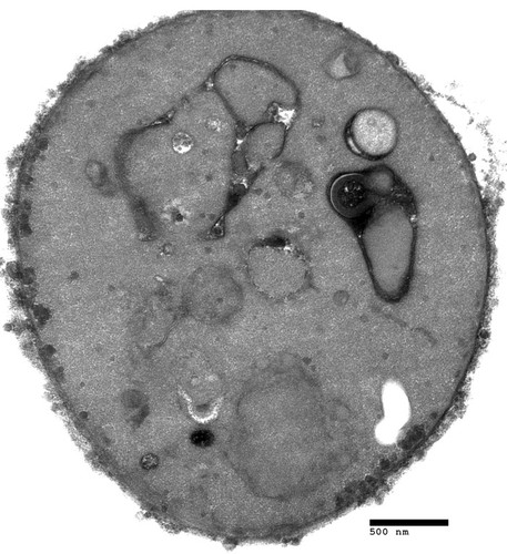 CIL:40433, Saccharomyces cerevisiae, sac1∆ mutant