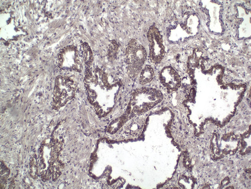 CIL:32737, Homo sapiens, endocrine-paracrine cell of prostate gland, basal cell of prostate epithelium, luminal cell of prostate epithelium, blood vessel endothelial cell, perineural cell, sheath cell, leukocyte, prostate stromal cell, smooth muscle cell of prostate