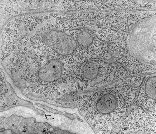 CIL:40992, Mus musculus, intestinal cell