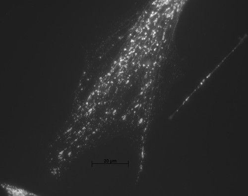 CIL:245, Mus musculus, fibroblast