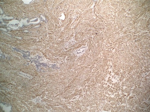 CIL:33471, Homo sapiens, endocrine-paracrine cell of prostate gland, basal cell of prostate epithelium, luminal cell of prostate epithelium, blood vessel endothelial cell, perineural cell, sheath cell, leukocyte, prostate stromal cell, smooth muscle cell of prostate