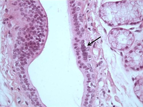 CIL: 53284, Homo sapiens, basal cell