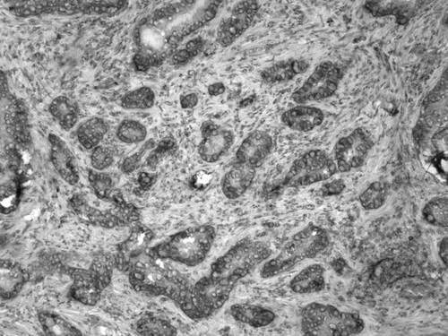 CIL:33664, Homo sapiens, endocrine-paracrine cell of prostate gland, basal cell of prostate epithelium, luminal cell of prostate epithelium, blood vessel endothelial cell, perineural cell, sheath cell, leukocyte, prostate stromal cell, smooth muscle cell of prostate