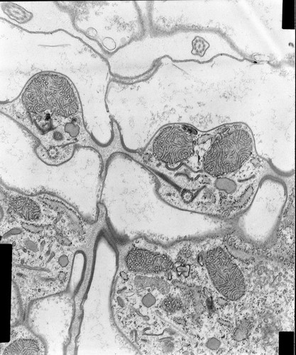 CIL:9015, Coleps hirtus, eukaryotic cell, Eukaryotic Protist, Ciliated Protist