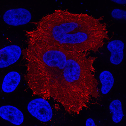 CIL: 53387, Homo sapiens, HeLa