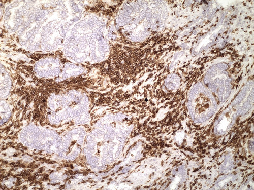 CIL:33233, Homo sapiens, endocrine-paracrine cell of prostate gland, basal cell of prostate epithelium, luminal cell of prostate epithelium, blood vessel endothelial cell, perineural cell, sheath cell, leukocyte, prostate stromal cell, smooth muscle cell of prostate