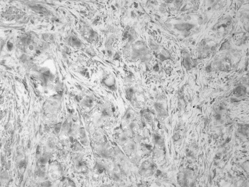 CIL:33612, Homo sapiens, endocrine-paracrine cell of prostate gland, basal cell of prostate epithelium, luminal cell of prostate epithelium, blood vessel endothelial cell, perineural cell, sheath cell, leukocyte, prostate stromal cell, smooth muscle cell of prostate