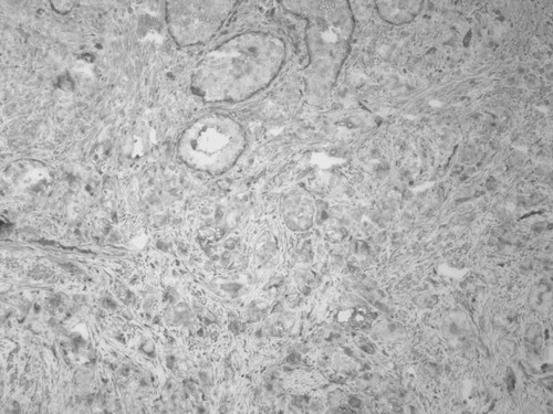 CIL:33610, Homo sapiens, endocrine-paracrine cell of prostate gland, basal cell of prostate epithelium, luminal cell of prostate epithelium, blood vessel endothelial cell, perineural cell, sheath cell, leukocyte, prostate stromal cell, smooth muscle cell of prostate