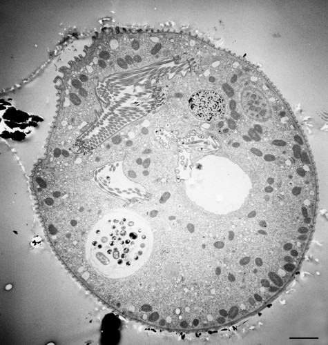 CIL:36253, Vorticella convallaria, cell by organism, eukaryotic cell, Eukaryotic Protist, Ciliated Protist