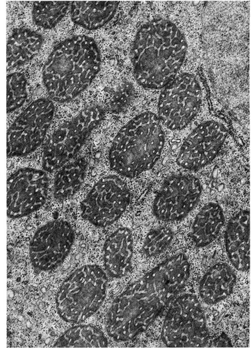 CIL:11433, Amoeba