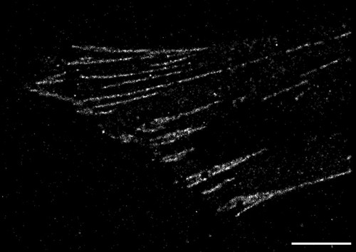 CIL:38602, Homo sapiens, fibroblast