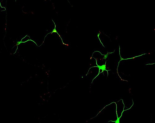 CIL:6142, Rattus, multipolar neuron