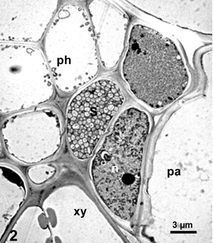 CIL:19124, Spiroplasma kunkelii, Zea mays, plant cell, prokaryotic cell