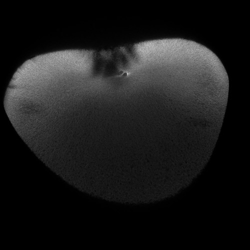 CIL:36513, Xenopus laevis, fertilized egg