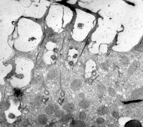 CIL:39322, Paramecium multimicronucleatum, cell by organism, eukaryotic cell, Eukaryotic Protist, Ciliated Protist