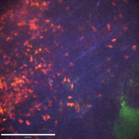 CIL:47600, Staphylococcus aureus, neutrophil, endothelial cell